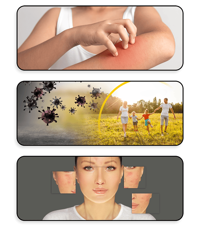 Psoriasis can have various causes